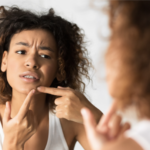 BEST WAYS TO GET RID OF WHITEHEADS